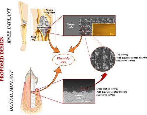 Schematic examples of biomedical applications where the developed 45S5 ...