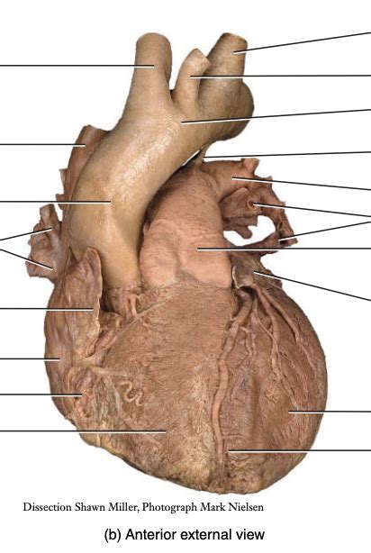 Surface Features Of The Heart Anterior Diagram Quizlet