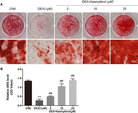 Frontiers Kaempferol Ameliorates The Inhibitory Activity Of