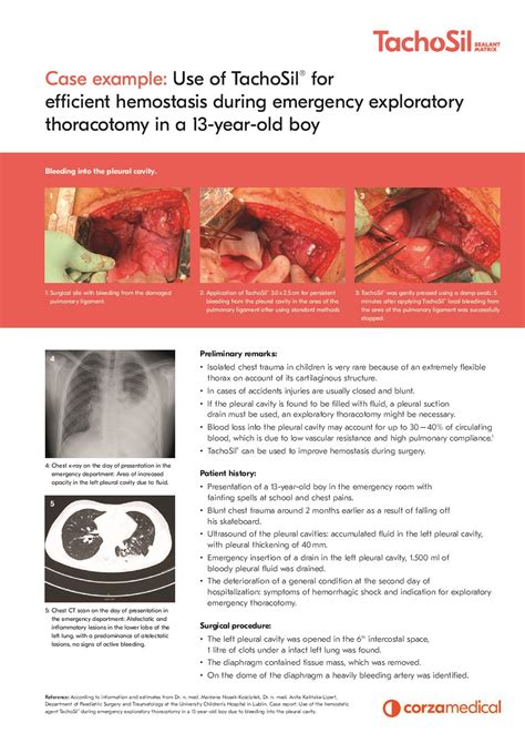 Hemostasis and sealing solutions in® in Pediatric Surgery Preview ...