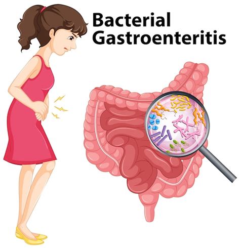 Diagramme Présentant Une Gastro Entérite Bactérienne Chez Lhomme