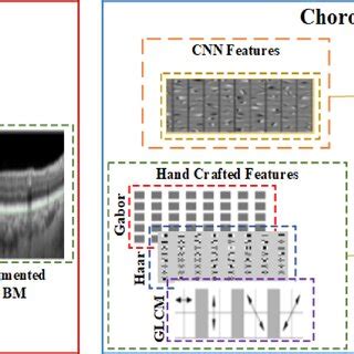 Deep Choroid Layer Segmentation Using Hybrid Features Extraction From