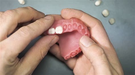 3d Printing Digital Denture With Dentafab 3d Printer And Powerresins