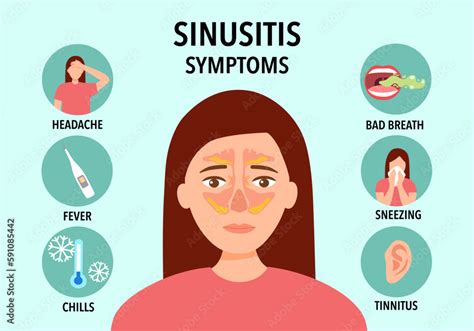 Sinusitis Symptoms Infographic Concept Vector Illustration Stock