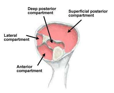 Anterior Compartment Syndrome - Symptoms, Causes & Treatment