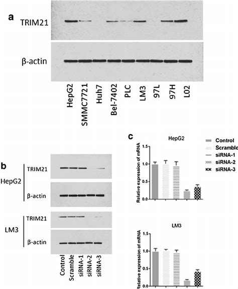 Expression Of Trim21 Protein In Hcc Cell Lines And The Efficiency Of Download Scientific