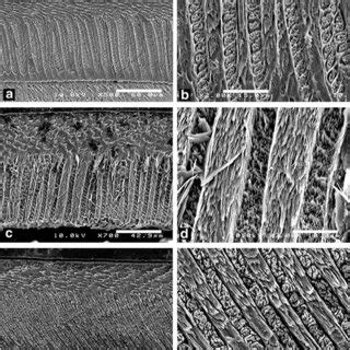 Scanning Electron Photomicrographs Of Dakhla C Lower Incisors Of