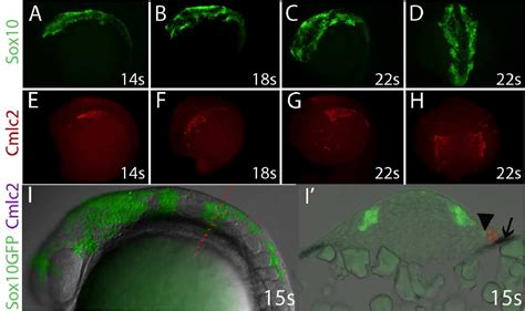 The Role Of Neural Crest Cells In Vertebrate Cardiac Outflow