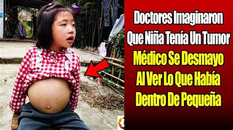 Doctores Imaginaron Que Ni Ten A Un Tumor Medico Se Desmayo Al Ver