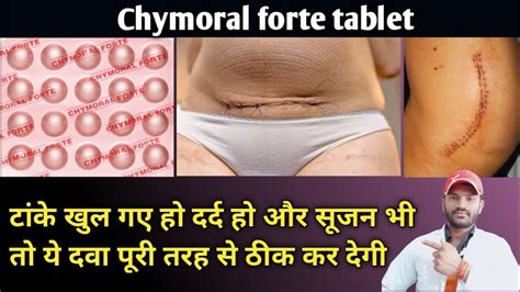 Chymoral Forte Tablet Use Dose Benefits And Side Effects Full Review In