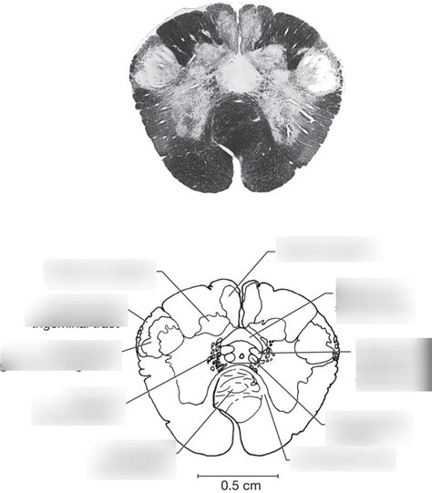 Caudal Medulla Diagram Quizlet