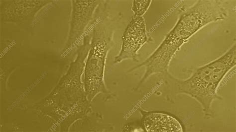 Hela Cells In Culture Light Microscopy Stock Video Clip K0056161