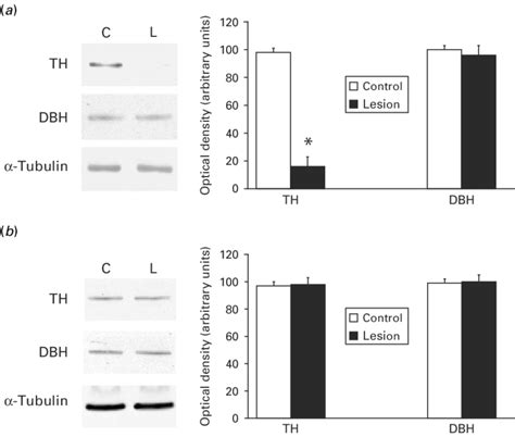 Representative Western Blots Showing Tyrosine Hydroxylase Th And Download Scientific Diagram