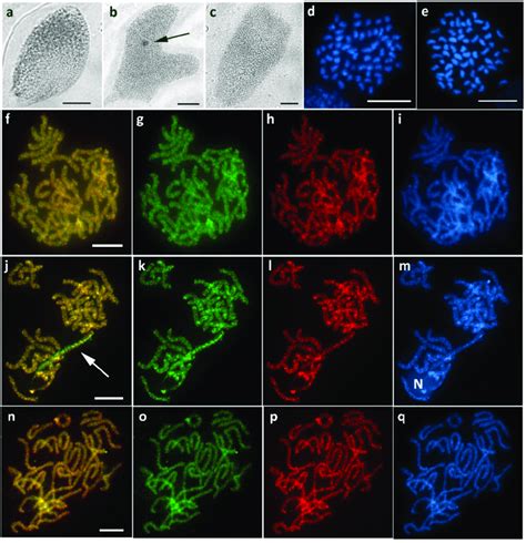 Wz Sex Chromosomes With Variable W In Pseudopanthera Macularia A C