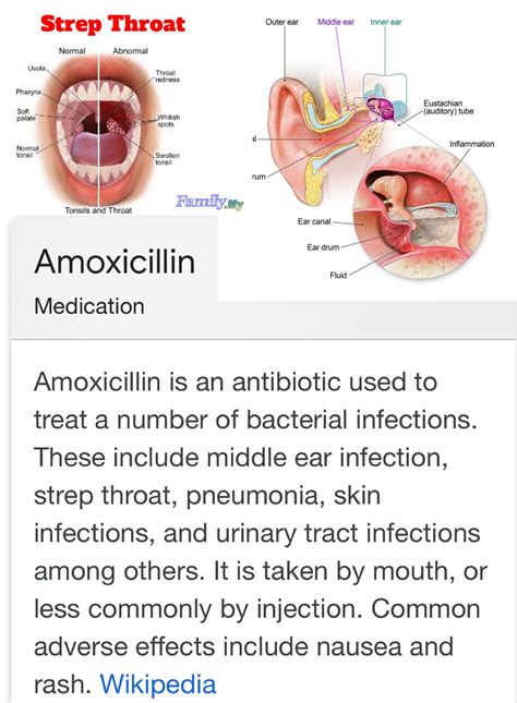 What Antibiotic Do You Take For Strep Throat Antibiotics Wont Work