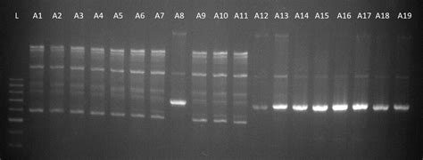 Corynebacterium amycolatum RAPD PCR types. L = ladder, strain 1.a =... | Download Scientific Diagram