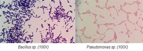 Gram Staining Of Bacillus And Pseudomonas Species Download Scientific Diagram