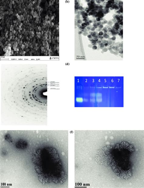 Morphological And Structural Characterizations Of Mnps A Sem Image