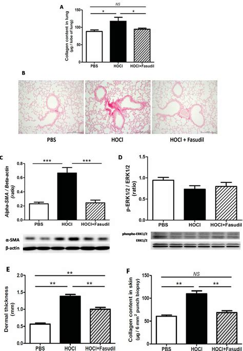 Figure Effects Of Fasudil On Lung And Skin Fibrosis In HOCl Mice