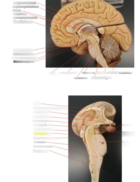 practical 2- brain stem Diagram | Quizlet