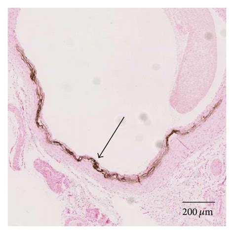 Von Kossa Stains Of The Vascular Calcifications Of Adenine Fed Rats Download Scientific Diagram