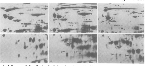 Figure 3 From Spore Germination And Rhizoid Differentiation In Onoclea