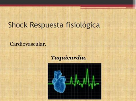 Ppt Urgencias Shock Powerpoint Presentation Free Download Id2849936