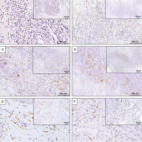 Detection Of Macrophages In Human Tongue Tissue By Cd163 And Cd11c Ihc Download Scientific