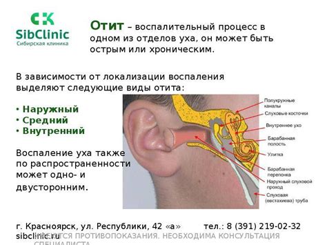 Как вылечить отит уха в домашних условиях: симптомы и лечение наружного ...