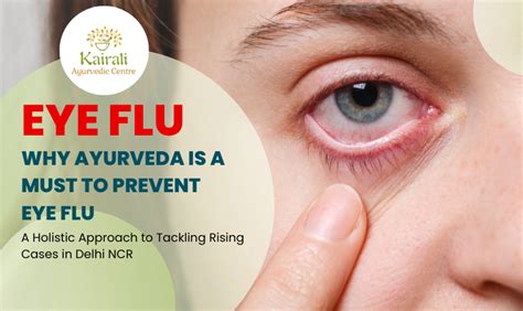 Why Ayurveda is a Must to Prevent Eye Flu: A Holistic Approach to ...