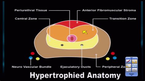 Prostate Zones Anatomy Anatomical Charts And Posters