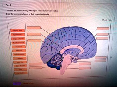 Solved Complete The Labeling Activity In The Figure Below Human Brain