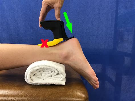 Ankle Mobilization Techniques To Improve Motion IOrtho