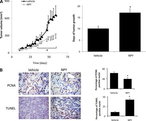 Npy Treatment Decreases Tumor Growth In An In Vivo Xenograft Model Of