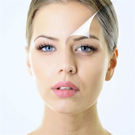 Dermal Fillers Treatment Duration Recovery And Longevity Isaac Luxe