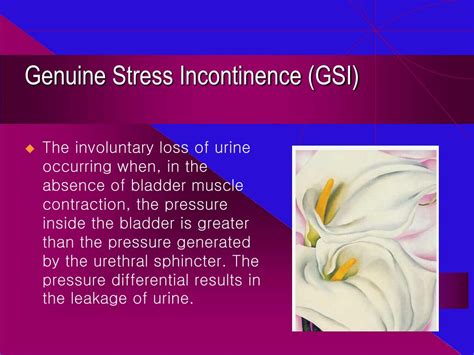 Ppt Urinary Incontinence Diagnosis And Management Powerpoint