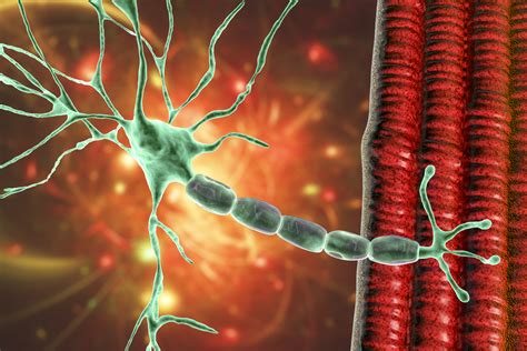 Fda Approves Tg Txs Briumvi For Relapsing Multiple Sclerosis Inside