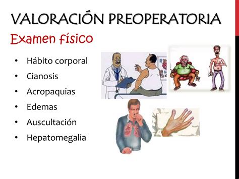 Evaluación preoperatoria cirugía de resección pulmonar PPT