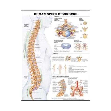 human spine disorders anatomical chart chiropractor chart