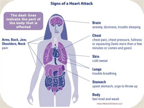 Symptoms Of A Heart Attack Or Stroke