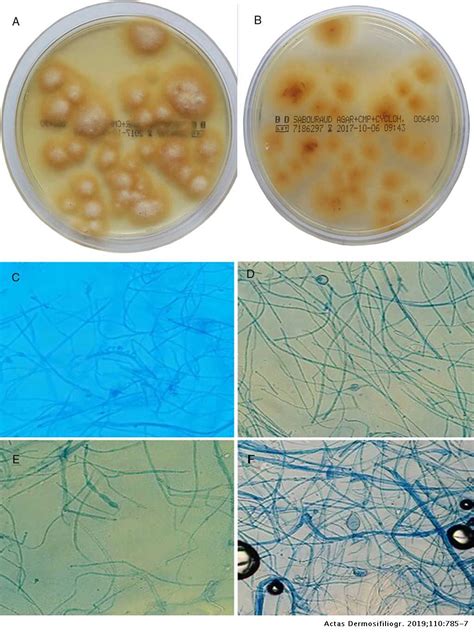 Microsporum Audouinii