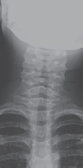 Female Cervical Spine Radiology Key