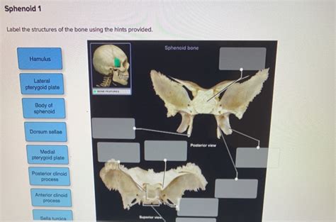 Solved Sphenoid 1 Label The Structures Of The Bone Using The