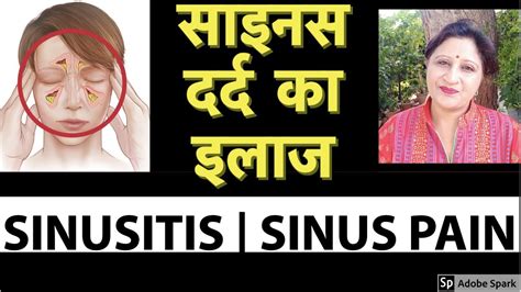 Sinusitis Treatment At Home Sinus Ka ilaj सइनस क इलज Hindi