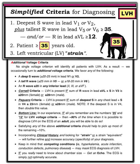 ECG Interpretation: ECG Interpretation Review #73 (LVH – Hypertrophy ...