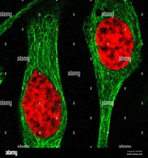 Two Human Cells In Interphase Light Micrograph Stock Photo Alamy