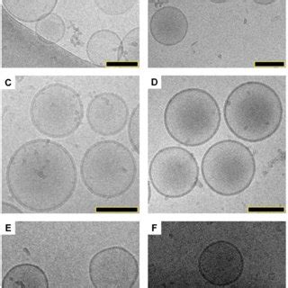 Structural Elucidation Of Liposomal Ija Cryo Tem Micrographs Of