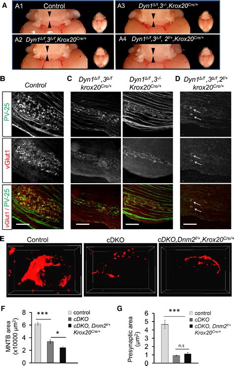 Figure 1 From Dynamin 1 And 3 Mediated Endocytosis Is Essential For