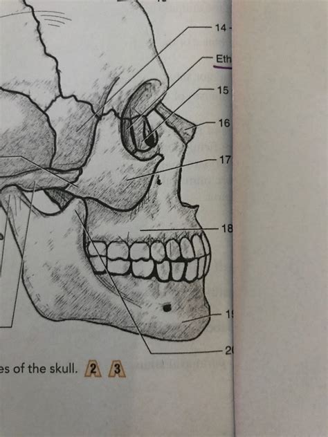 Lateral Side Of Skull Pt Diagram Quizlet