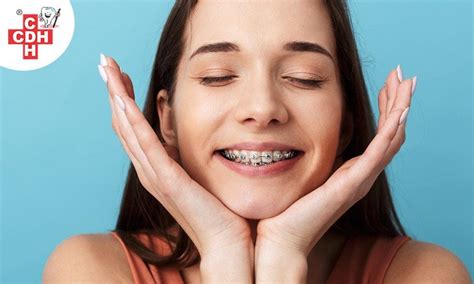 Dental Health Benefits Of Orthodontic Treatment 1 Cdh